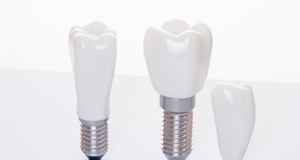 Ruthenium in Dental Implants